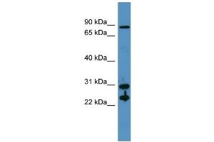 Western Blotting (WB) image for anti-Carbonic Anhydrase II (CA2) (N-Term) antibody (ABIN617260) (CA2 抗体  (N-Term))