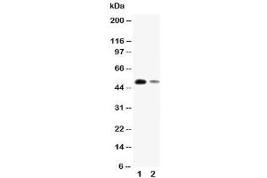 Western blot testing of KLF8 antibody and Lane 1:  SMMC-7721 (KLF8 抗体  (N-Term))