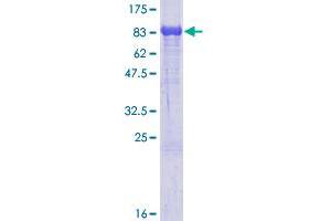 Image no. 1 for Arachidonate 15-Lipoxygenase B (ALOX15B) (AA 1-676) protein (GST tag) (ABIN1344917) (ALOX15B Protein (AA 1-676) (GST tag))