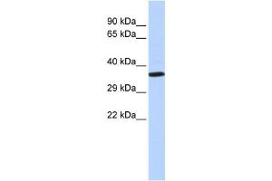 WB Suggested Anti-NKX2-2 Antibody Titration:  0. (Nkx2-2 抗体  (N-Term))