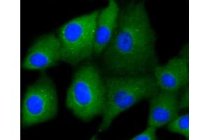 A549 cells were fixed in paraformaldehyde, permeabilized with 0. (Cytokeratin 7 抗体)