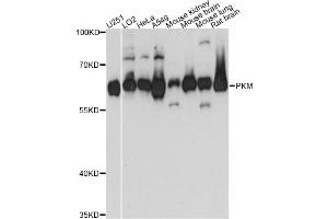 Western blot analysis of extracts of various cell lines, using PKM antibody. (PKM 抗体)