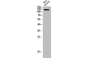 Western Blot analysis of RAT-BRAIN cells using Ataxin-2 Polyclonal Antibody (Ataxin 2 抗体  (Internal Region))