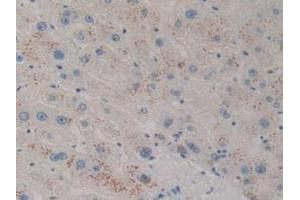 IHC-P analysis of Human Liver Tissue, with DAB staining. (CXCL12 抗体)