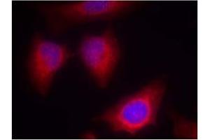 Image no. 2 for anti-Protein Kinase C, theta (PRKCQ) (AA 674-678) antibody (ABIN197567) (PKC theta 抗体  (AA 674-678))