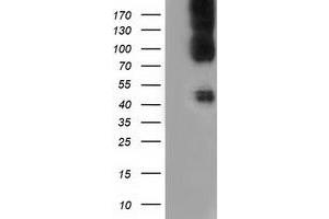 HEK293T cells were transfected with the pCMV6-ENTRY control (Left lane) or pCMV6-ENTRY CD80 (Right lane) cDNA for 48 hrs and lysed. (CD80 抗体)