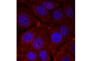 Immunofluorescence (IF) image for anti-Synuclein, alpha (SNCA) (pTyr136) antibody (ABIN1870623) (SNCA 抗体  (pTyr136))
