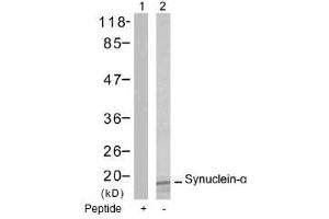 Image no. 1 for anti-Synuclein, alpha (SNCA) (Tyr125) antibody (ABIN197502) (SNCA 抗体  (Tyr125))