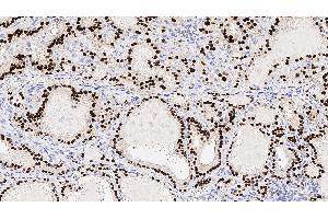 Human thyroid: immunohistochemical staining for Thyroid Transcription Factor-1. (NKX2-1 抗体  (N-Term))