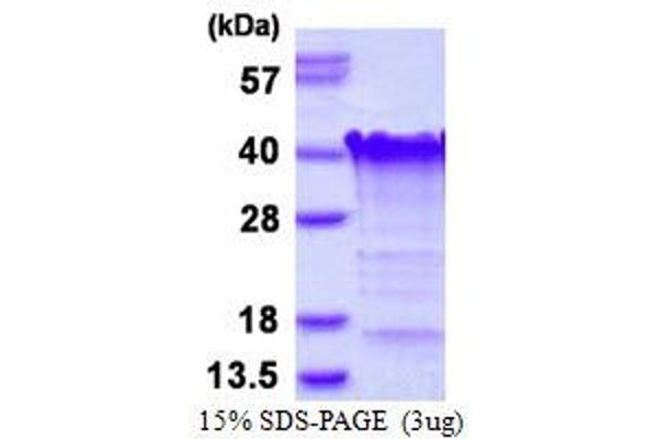 TCEAL3 Protein (His tag)