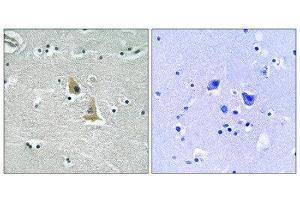 Immunohistochemistry (IHC) image for anti-Neutrophil Cytosol Factor 1 (NCF1) (Ser345) antibody (ABIN1848361) (NCF1 抗体  (Ser345))