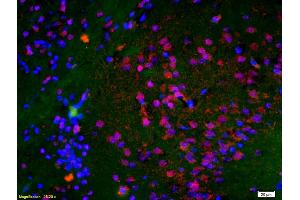 Formalin-fixed and paraffin embedded rat brain labeled with Anti-Histone H3 (Di Methyl K9) Polyclonal Antibody, Unconjugated (ABIN703886) at 1:200 followed by conjugation to the secondary antibody Goat Anti-Rabbit IgG, Cy3 conjugated used at 1:200 dilution for 40 minutes at 37 °C and DAPI staining (Histone 3 抗体  (H3K9me))