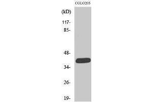 Western Blotting (WB) image for anti-Solute Carrier Family 22 Member 18 (SLC22A18) (C-Term) antibody (ABIN3176679) (ORCTL-2/SLC22A18 抗体  (C-Term))
