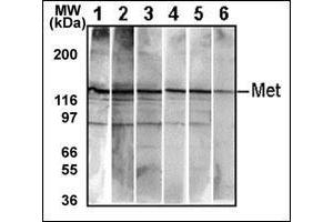 Western Blotting (WB) image for anti-Met Proto-Oncogene (MET) (Catalytic Domain) antibody (ABIN356341) (c-MET 抗体  (Catalytic Domain))
