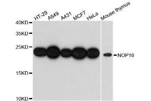 Western blot analysis of extracts of various cell lines, using NOP16 antibody. (NOP16 抗体  (AA 1-178))