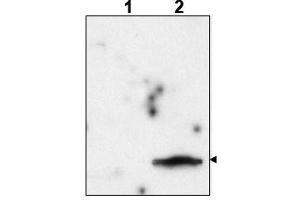 Image no. 1 for anti-FIV P24 Gag (Internal Region) antibody (ABIN401386) (FIV P24 Gag (Internal Region) 抗体)