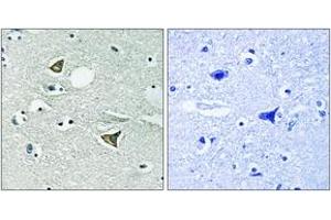 Immunohistochemistry analysis of paraffin-embedded human brain tissue, using Girdin (Ab-1417) Antibody. (Girdin 抗体  (AA 1383-1432))