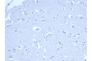 IHC analysis of formalin-fixed, paraffin-embedded human brain. (Recombinant p21 抗体  (AA 1-100))