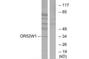 Western Blotting (WB) image for anti-Olfactory Receptor, Family 52, Subfamily W, Member 1 (OR52W1) (C-Term) antibody (ABIN1853147) (OR52W1 抗体  (C-Term))