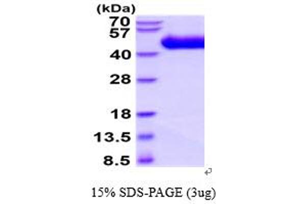 IL1RL1 Protein (AA 19-328) (His tag)