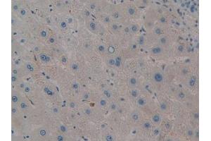 IHC-P analysis of Human Liver Tissue, with DAB staining. (PIM2 抗体  (AA 82-291))