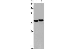 Western Blotting (WB) image for anti-Four and A Half LIM Domains 1 (FHL1) antibody (ABIN2423471) (FHL1 抗体)