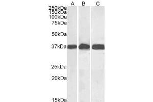 Western Blotting (WB) image for anti-Glyceraldehyde-3-Phosphate Dehydrogenase (GAPDH) (C-Term) antibody (ABIN185240)