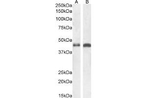 Western Blotting (WB) image for anti-Arrestin, beta 2 (ARRB2) (Internal Region) antibody (ABIN185395)