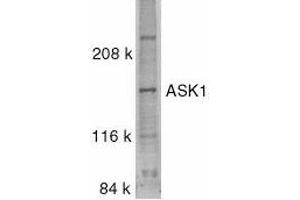 Western blot analysis of ASK1 in SW1353 whole cell lysate with ASK1 antibody at 0. (ASK1 抗体)