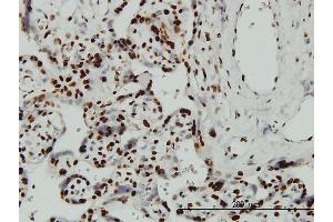 Immunostaining (ISt) image for anti-AT Rich Interactive Domain 3A (BRIGHT-Like) (ARID3A) (AA 317-416) antibody (ABIN560650)