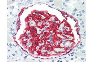 Human Kidney: Formalin-Fixed, Paraffin-Embedded (FFPE) (PODXL 抗体)