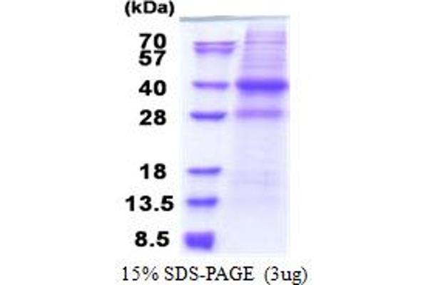 CAPZA2 Protein (AA 1-286) (His tag)