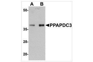 Western blot analysis of PPAPDC3 in mouse heart tissue lysate with PPAPDC3 antibody at (A) 1 and (B) 2 μg/ml. (PPAPDC3 抗体  (N-Term))