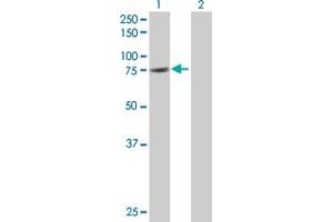 Western Blotting (WB) image for GAS6 293T Cell Transient Overexpression Lysate(Denatured) (ABIN1331915)