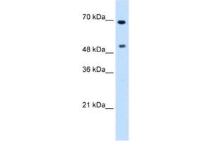 Western Blotting (WB) image for anti-Myc Proto-Oncogene protein (MYC) antibody (ABIN2460542) (c-MYC 抗体)
