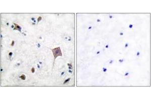 Immunohistochemistry analysis of paraffin-embedded human brain tissue, using PYK2 (Ab-580) Antibody. (PTK2B 抗体  (AA 546-595))