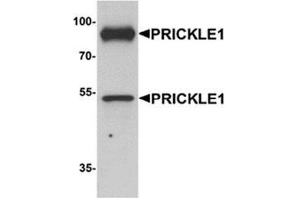 PRICKLE1 抗体  (C-Term)