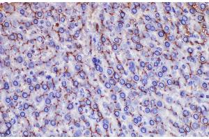 Immunohistochemistry of paraffin-embedded Rat liver using Ceacam1 Polycloanl Antibody at dilution of 1:200 (CEACAM1 抗体)