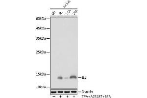 Western blot analysis of extracts of Jurkat cells, using IL2 antibody (ABIN7267993) at 1:1000 dilution. (IL-2 抗体)