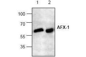 Image no. 1 for anti-Forkhead Box O4 (FOXO4) antibody (ABIN127087) (FOXO4 抗体)