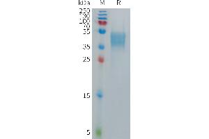 Human Protein, mFc Tag on SDS-PAGE under reducing condition. (GPR75 Protein (AA 1-46) (mFc Tag))