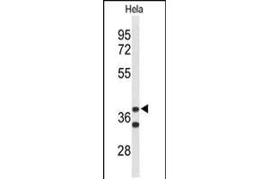 Western blot analysis of CYTH3 Antibody in Hela cell line lysates (35ug/lane). (Cytohesin 3 抗体  (C-Term))