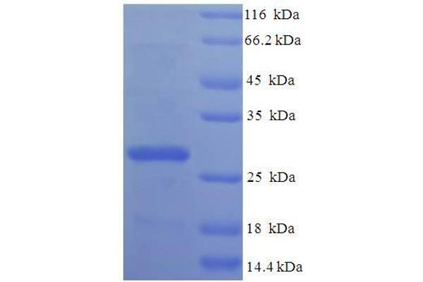 MRPL20 Protein (AA 46-149) (His-SUMO Tag)