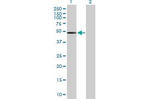 Western Blot analysis of ACTR3B expression in transfected 293T cell line by ACTR3B MaxPab polyclonal antibody. (ACTR3B 抗体  (AA 1-418))