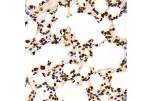 Immunohistochemistry (IHC) image for anti-Histone 3 (H3) (H3K4me) antibody (ABIN3023251)