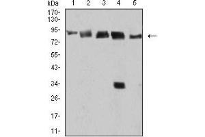 Western Blotting (WB) image for anti-DEAD (Asp-Glu-Ala-Asp) Box Polypeptide 1 (DDX1) (AA 642-740) antibody (ABIN5899136) (DDX1 抗体  (AA 642-740))