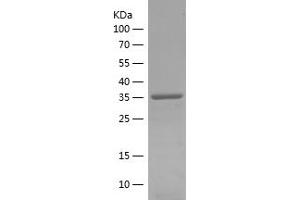 CAPRIN2 Protein (AA 377-595) (His tag)