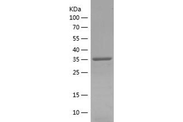 CAPRIN2 Protein (AA 377-595) (His tag)