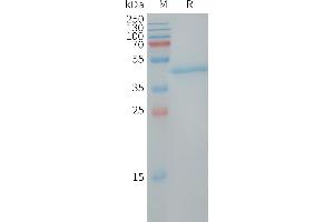 Human LY6H Protein, hFc Tag on SDS-PAGE under reducing condition. (LY6H Protein (AA 26-115) (Fc Tag))