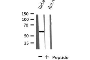 Western blot analysis on HeLa cells lysate using KLF4 antibody (KLF4 抗体)